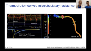 Thermodilution-derived microcirculatory resistance