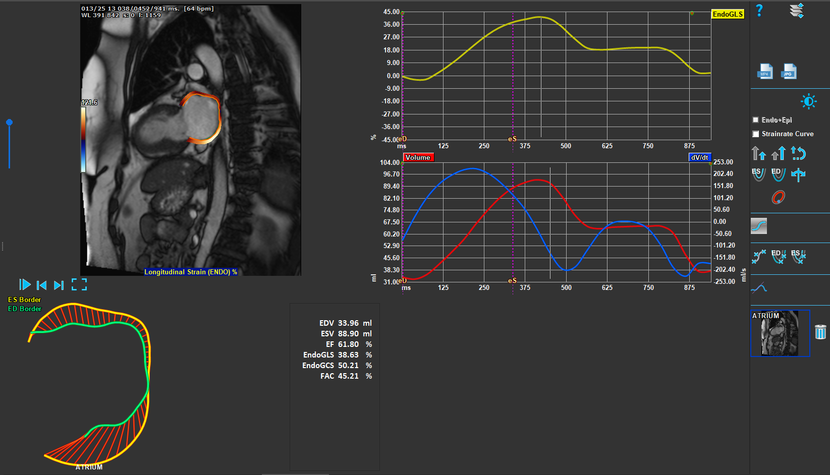 Atrial Strain_Module1