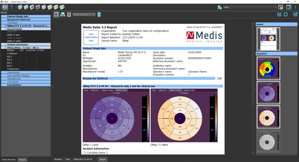 Medis Suite 3.2 Report T1 Mapping module 4