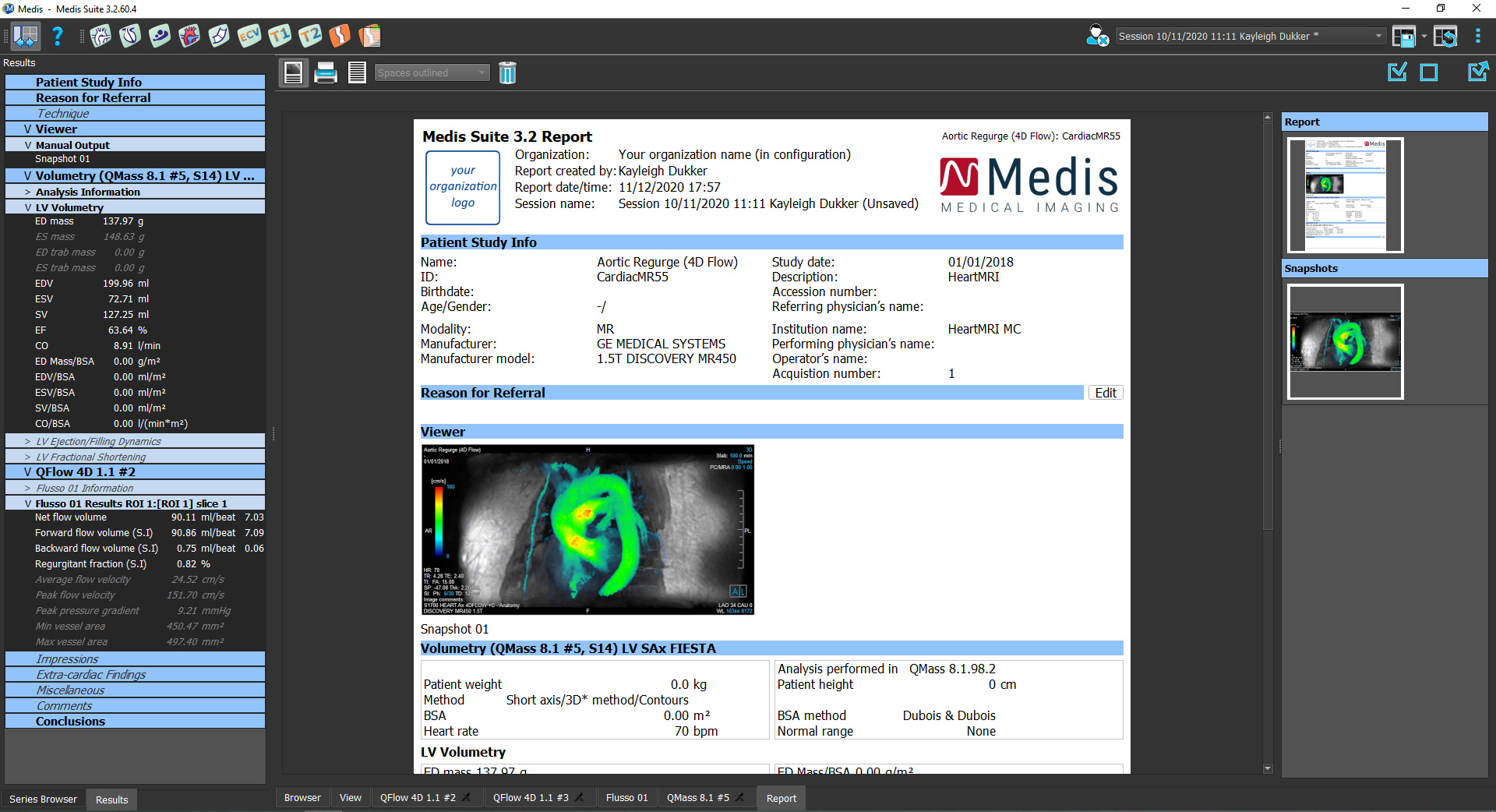 Medis Suite 3.2 Report Module 4