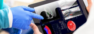 Medis Suite Ultrasound image on tablet