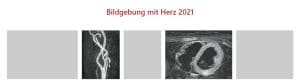 Bildgebung mit Herz