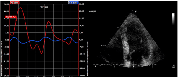 Medis Suite Ultrasound: The blog
