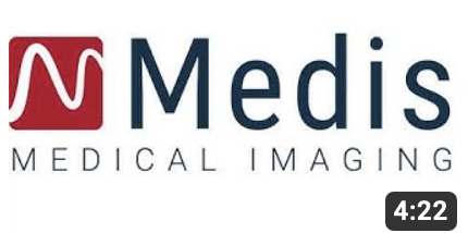 Metrics of the heart - medisimaging