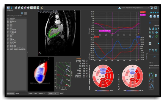 Medis Suite MR product screen shot - cardiac MRI - Software