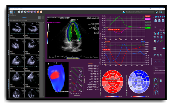 Medis Suite ultrasound product screen