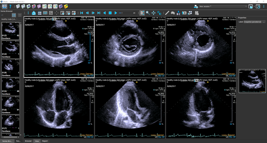 Medis Ultrasound viewer