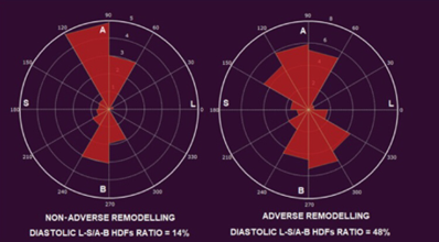 Medis MR CT Hemodynamic Forces