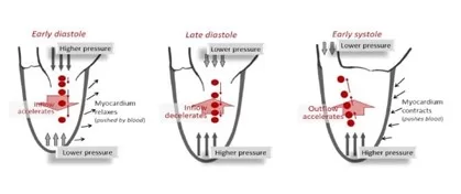 Pressure flow distribution cardiac cycle. Measuring cardiac function using Medis