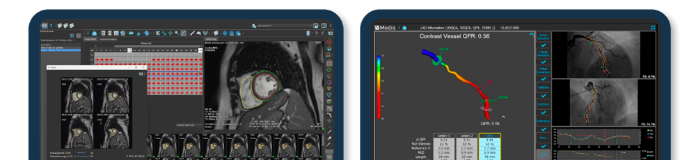 New update Medis QFR and Medis Suite MR CT Medis NPI 2023